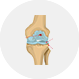 Osteoarthritis